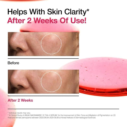(3 Units) ANUA Niacinamide 10% + TXA 4% Dark Spot Correcting Serum